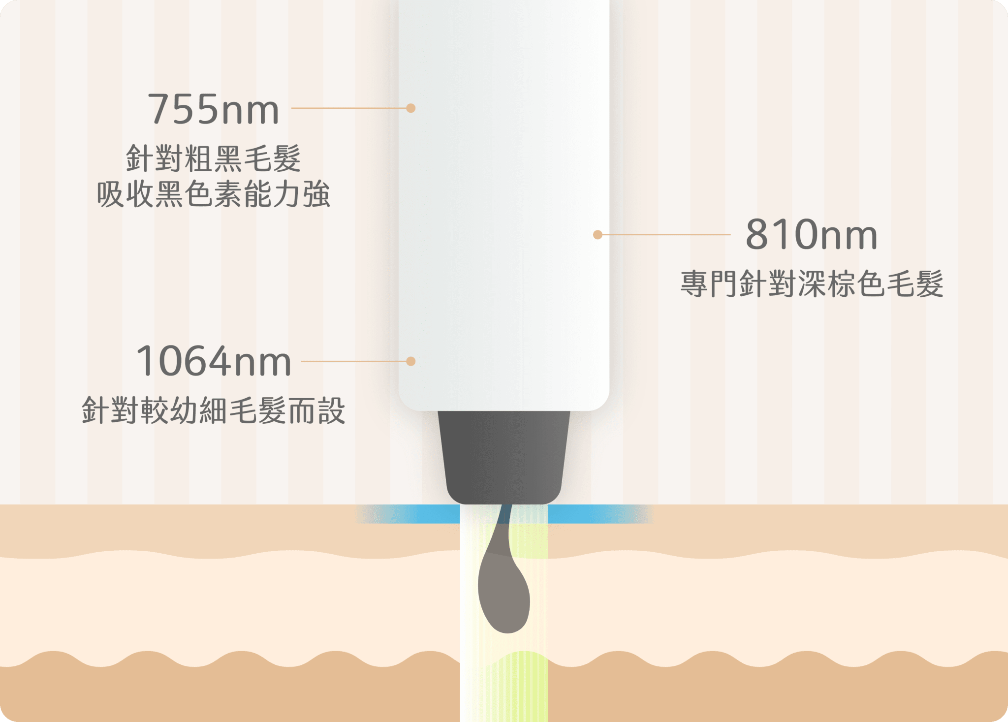 755激光脫毛
