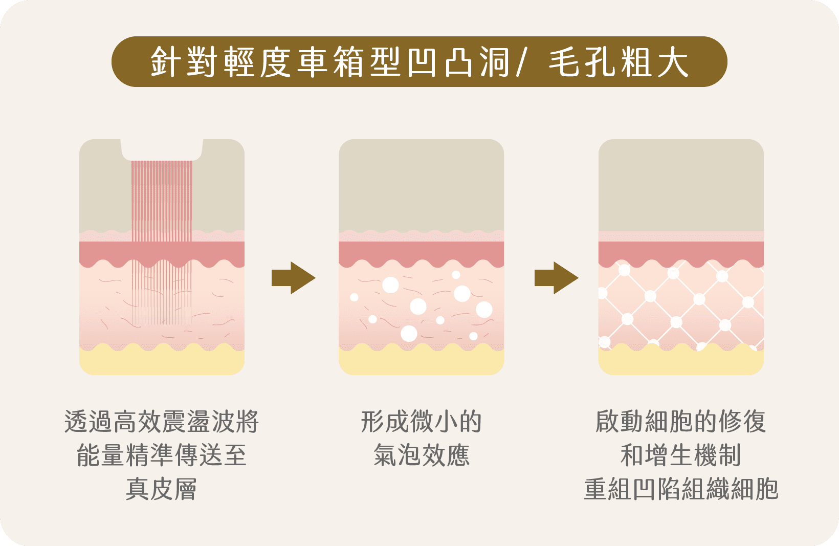 皮秒蜂巢