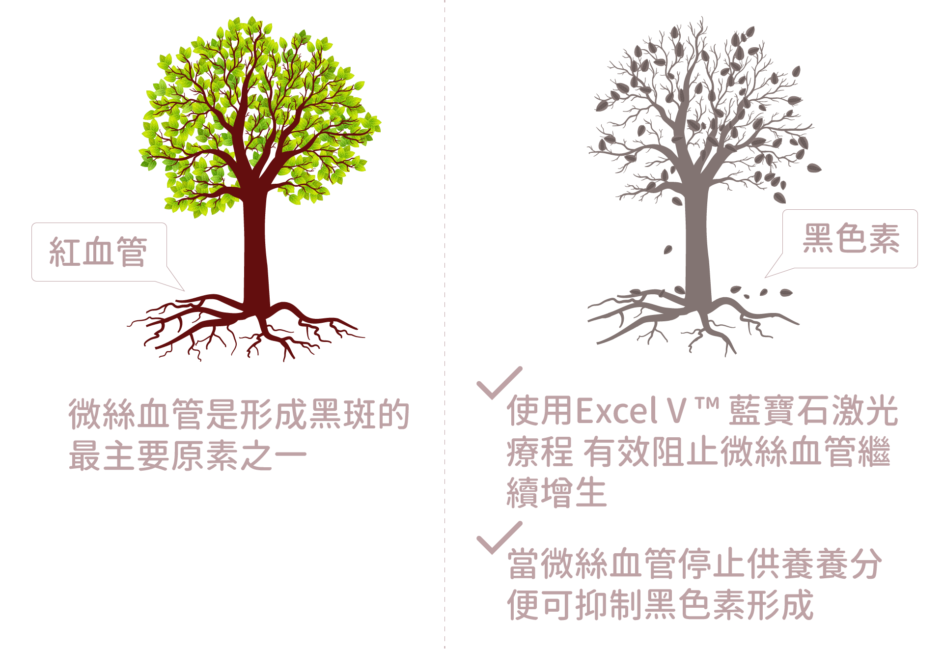 Excel V退紅原理