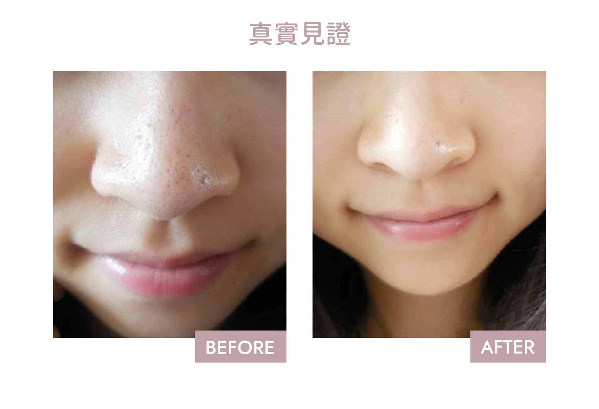 Aqua Peel效果