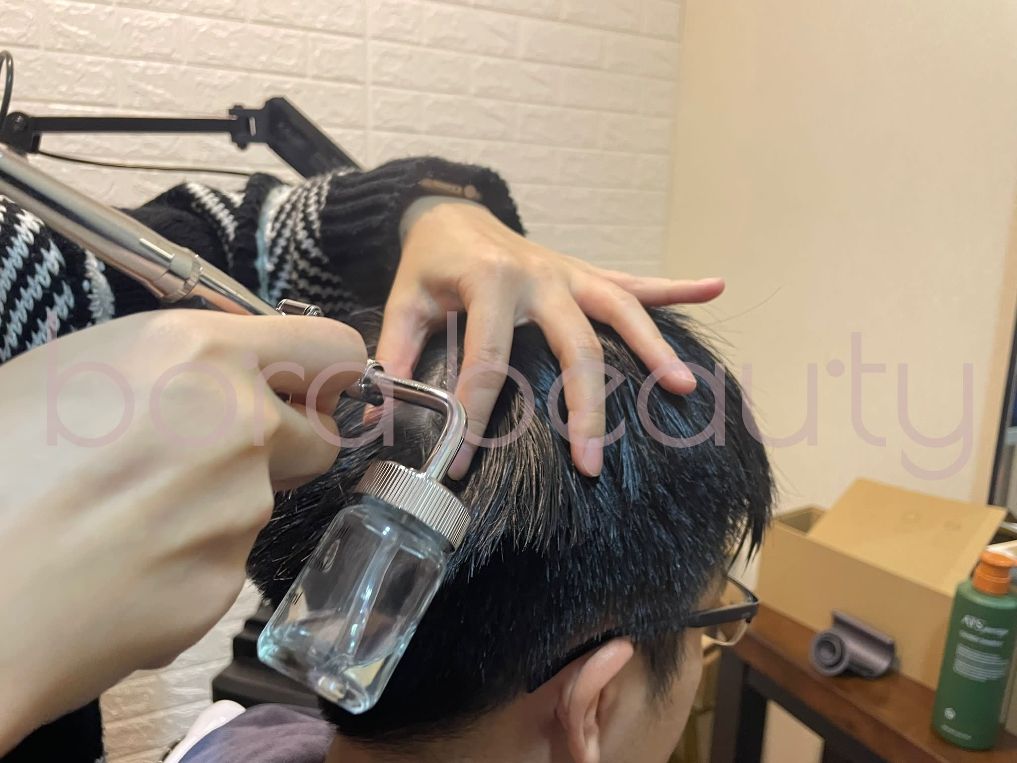 激光生髮刺激技術