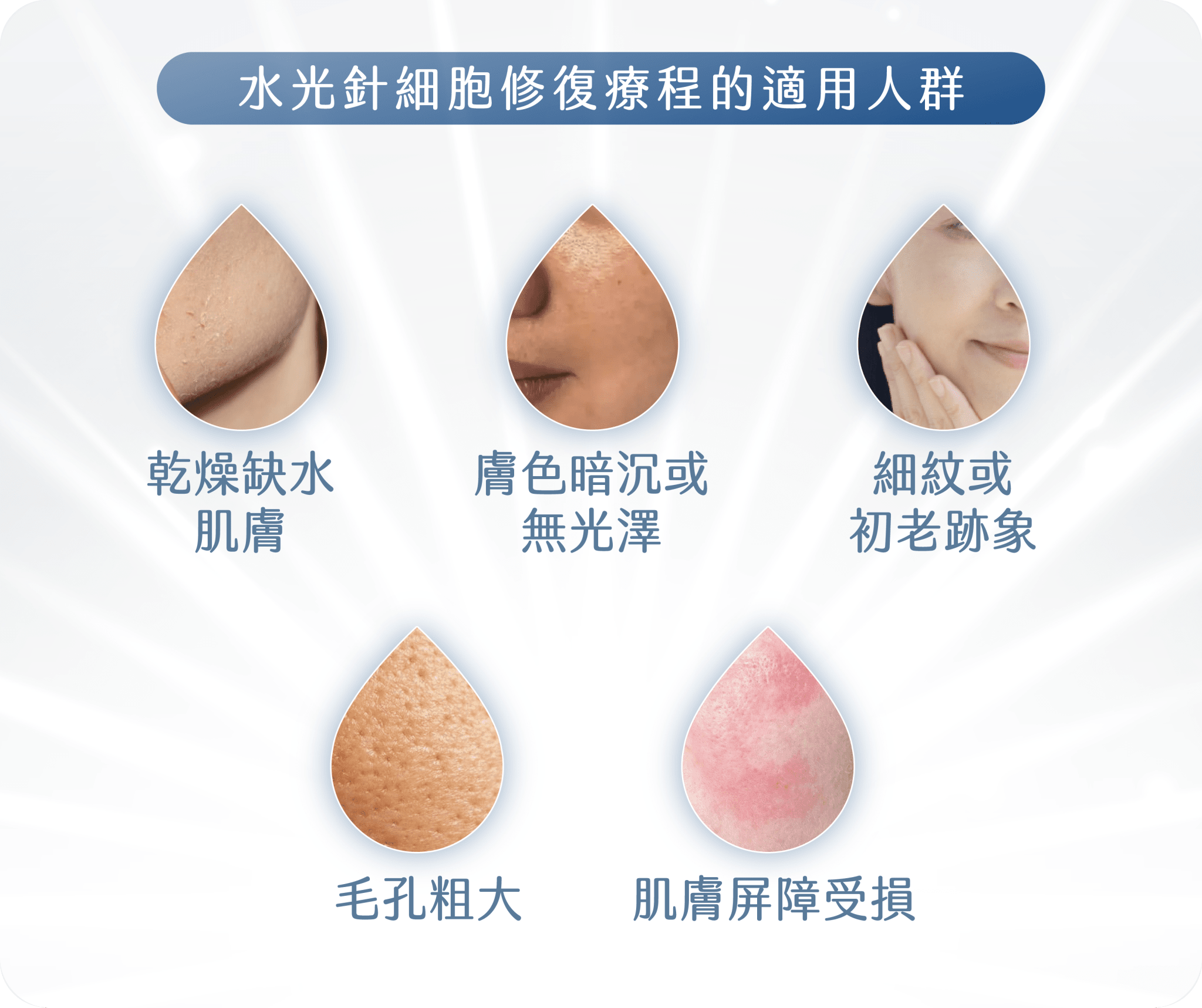 水光針 價錢