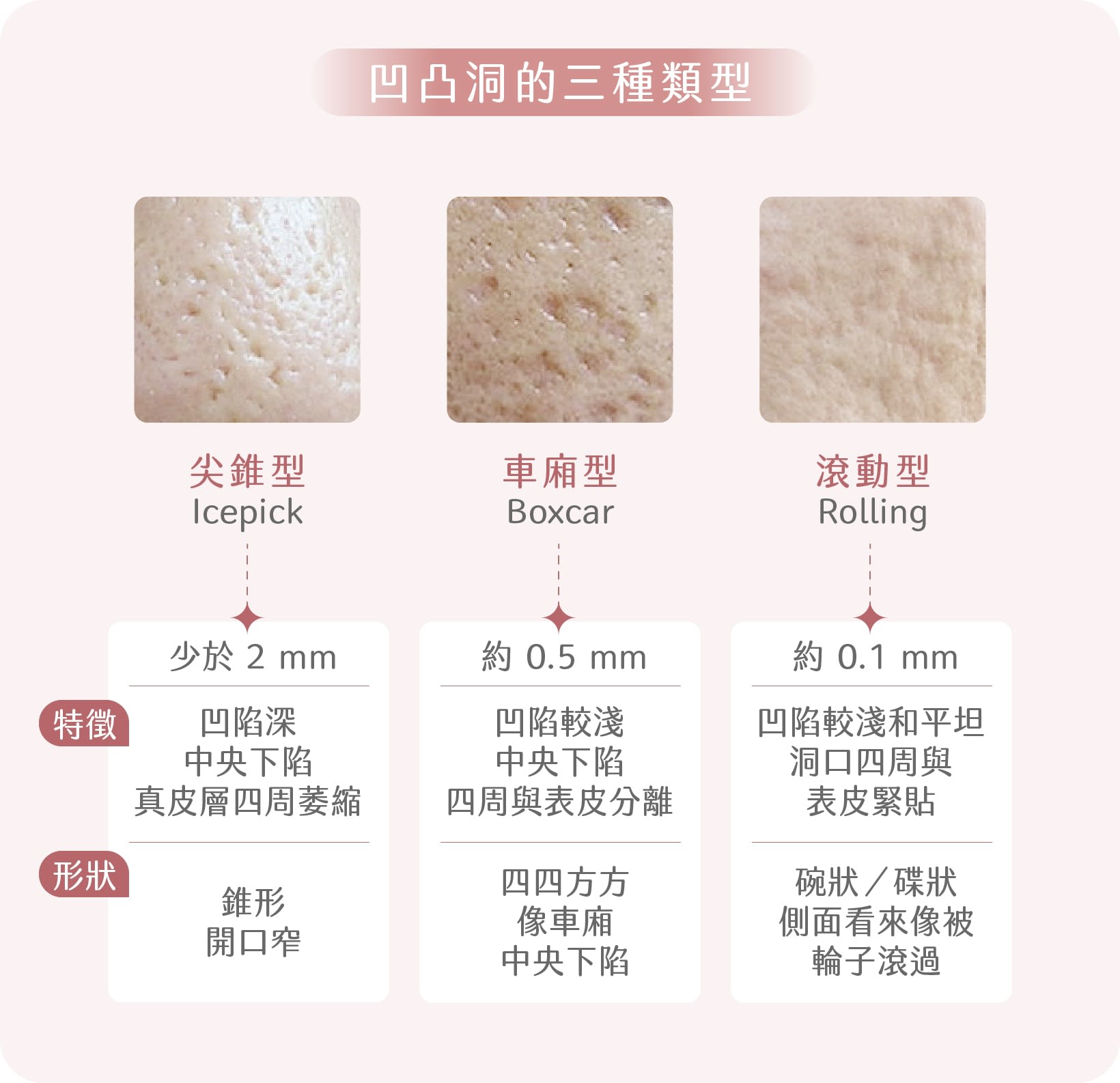 凹凸洞類型介紹