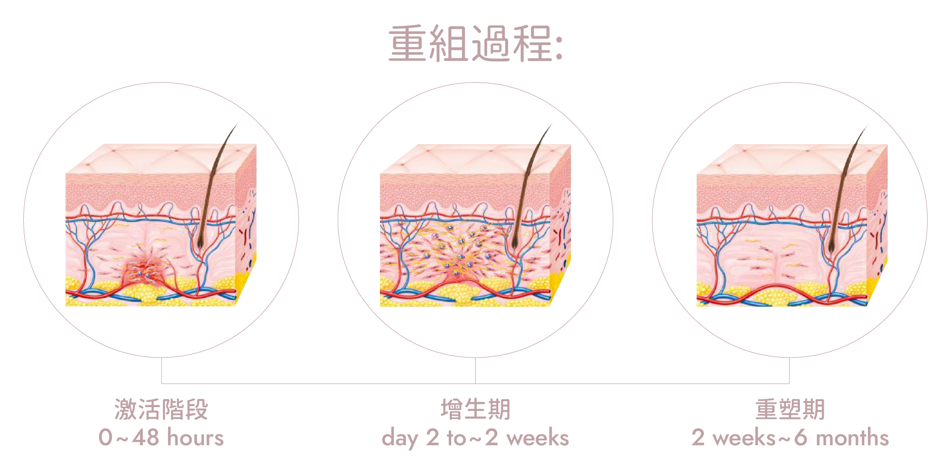 hifu原理 膠原蛋白再生
