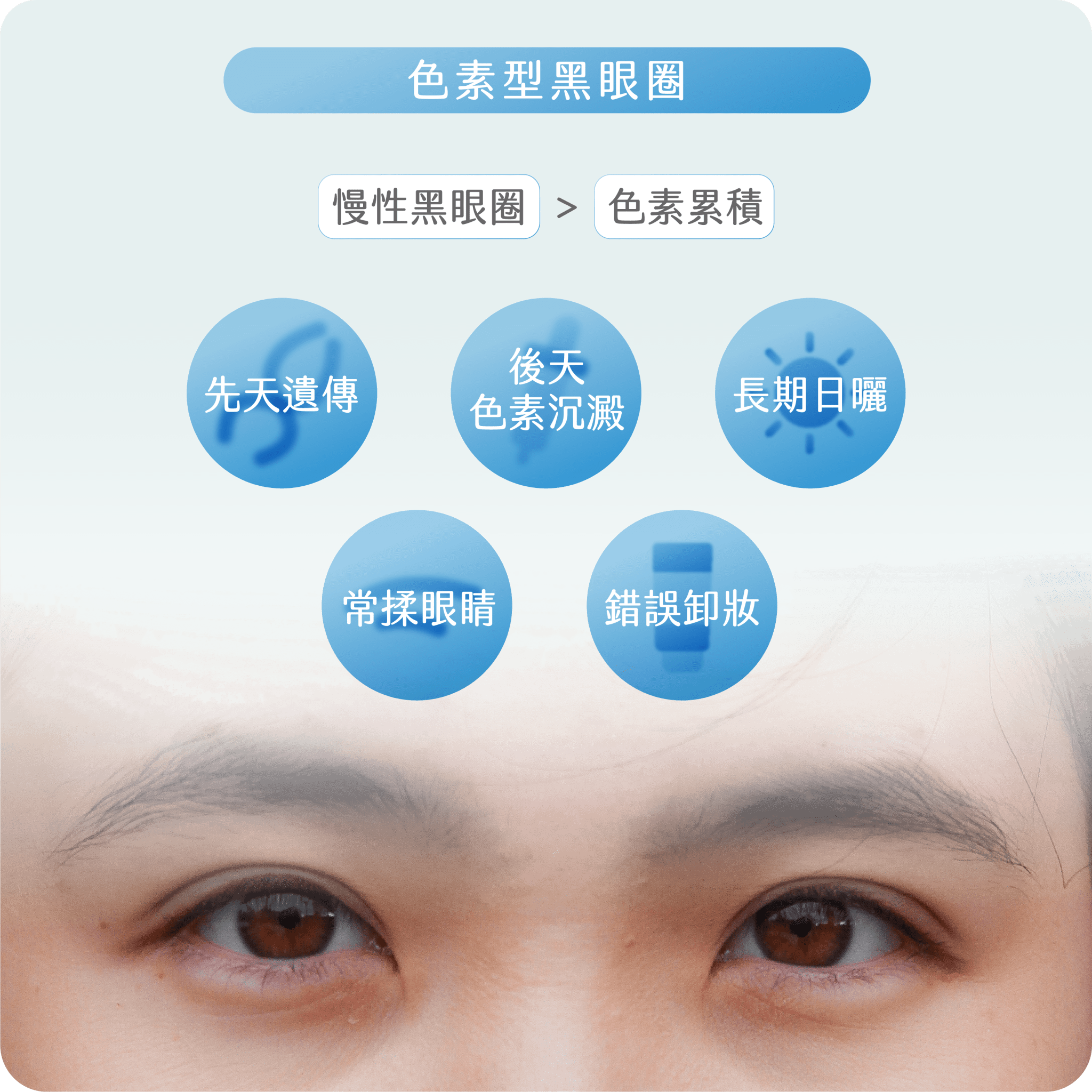 黑眼圈類型