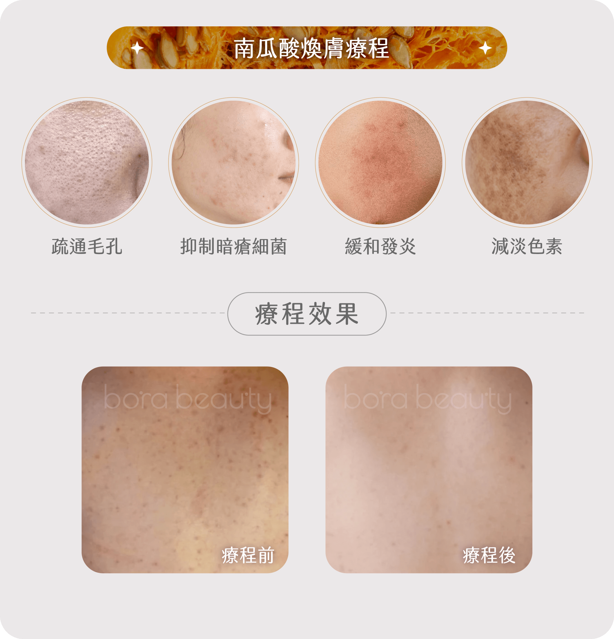  治療思路
