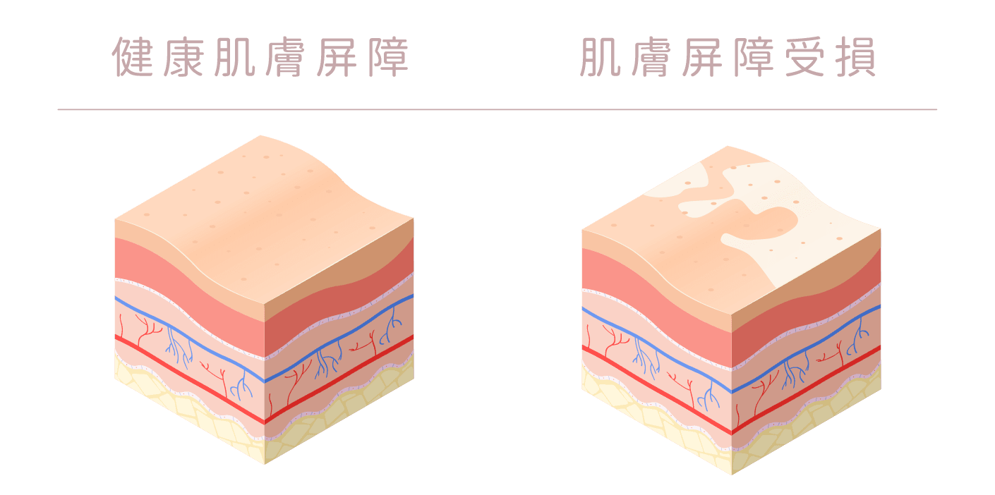 肌膚屏障，抵抗力