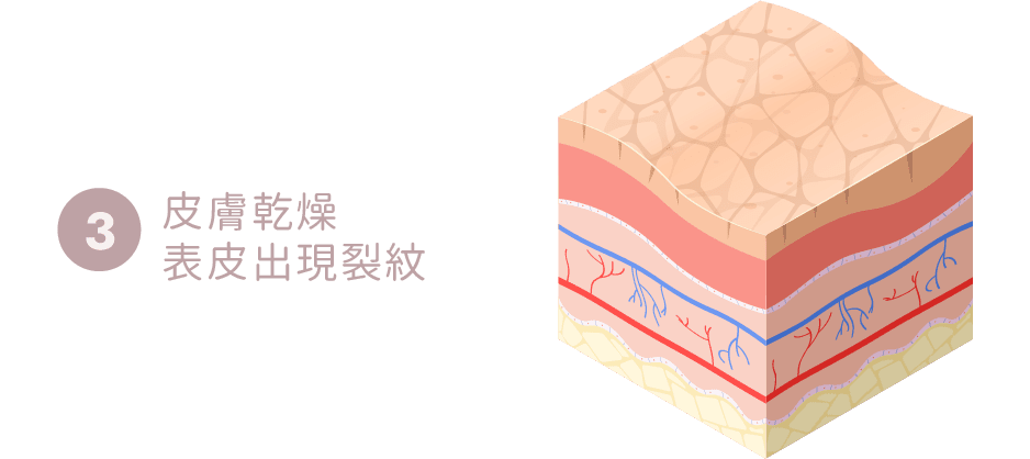 膚色不均原因-皮膚乾燥