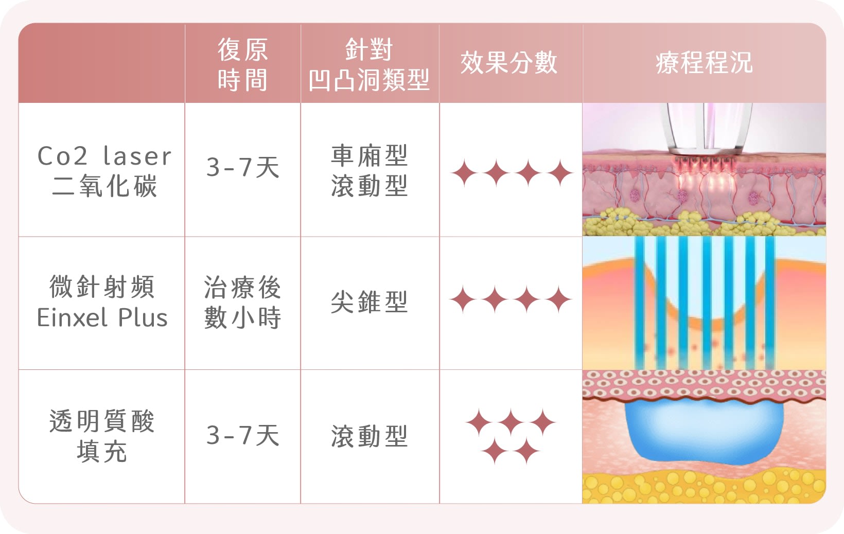 凹凸洞治療
