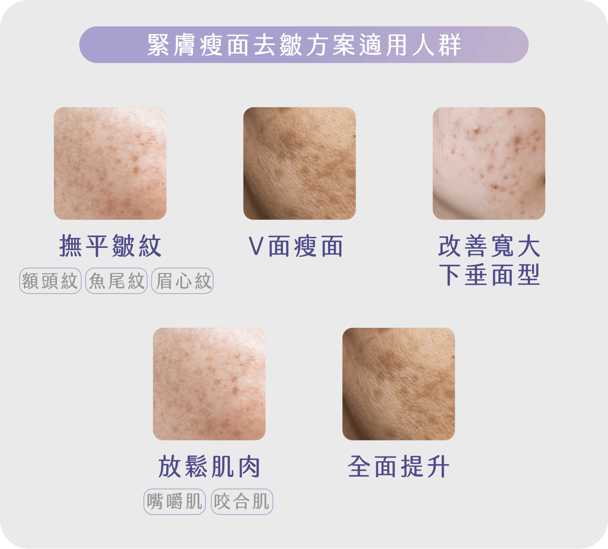 緊膚瘦面去皺方案適合人群