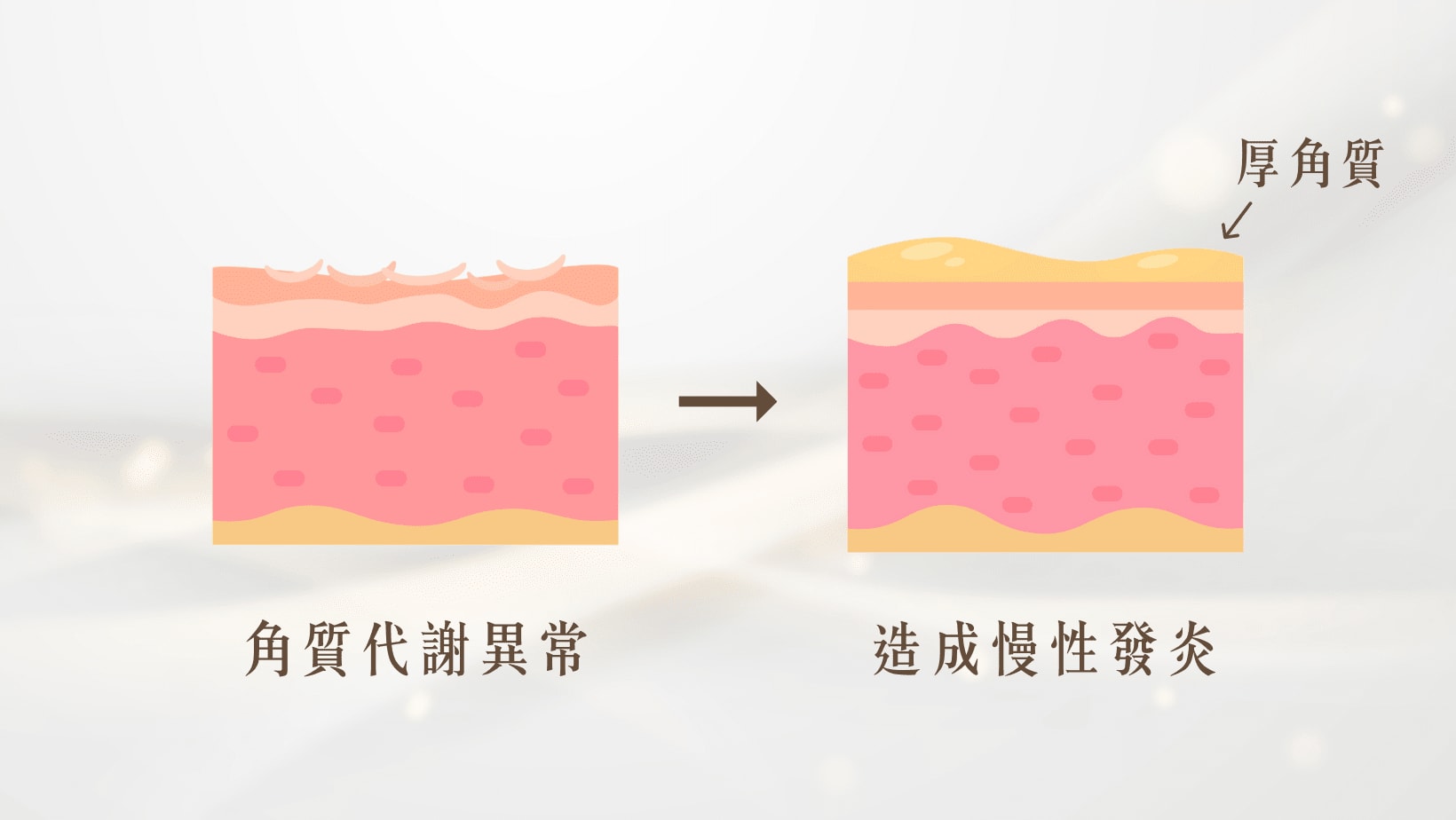 皮膚角質細胞