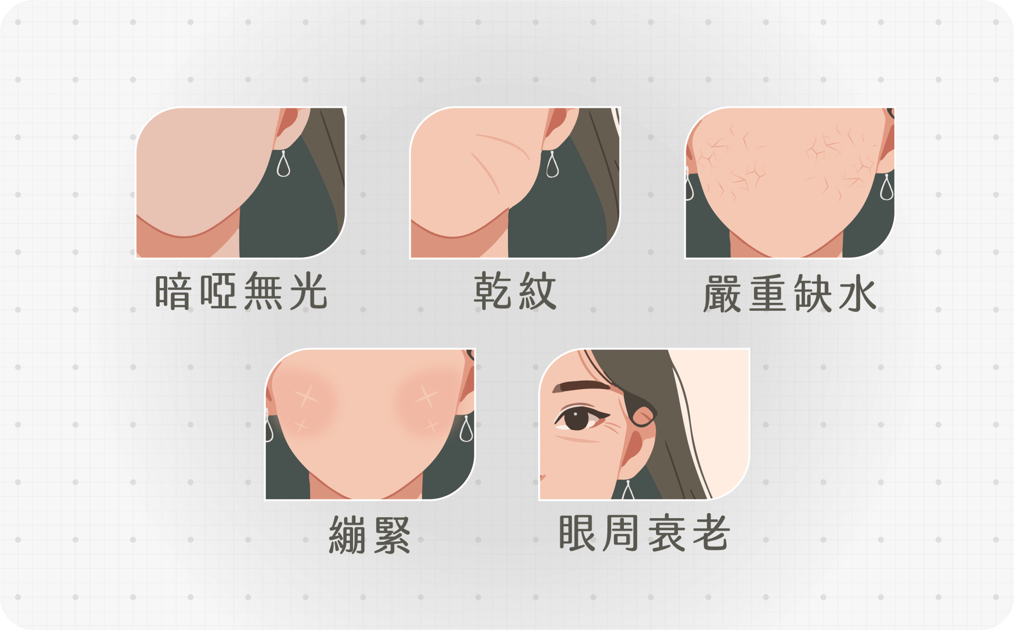 Teosyal Redensity I 適合人士