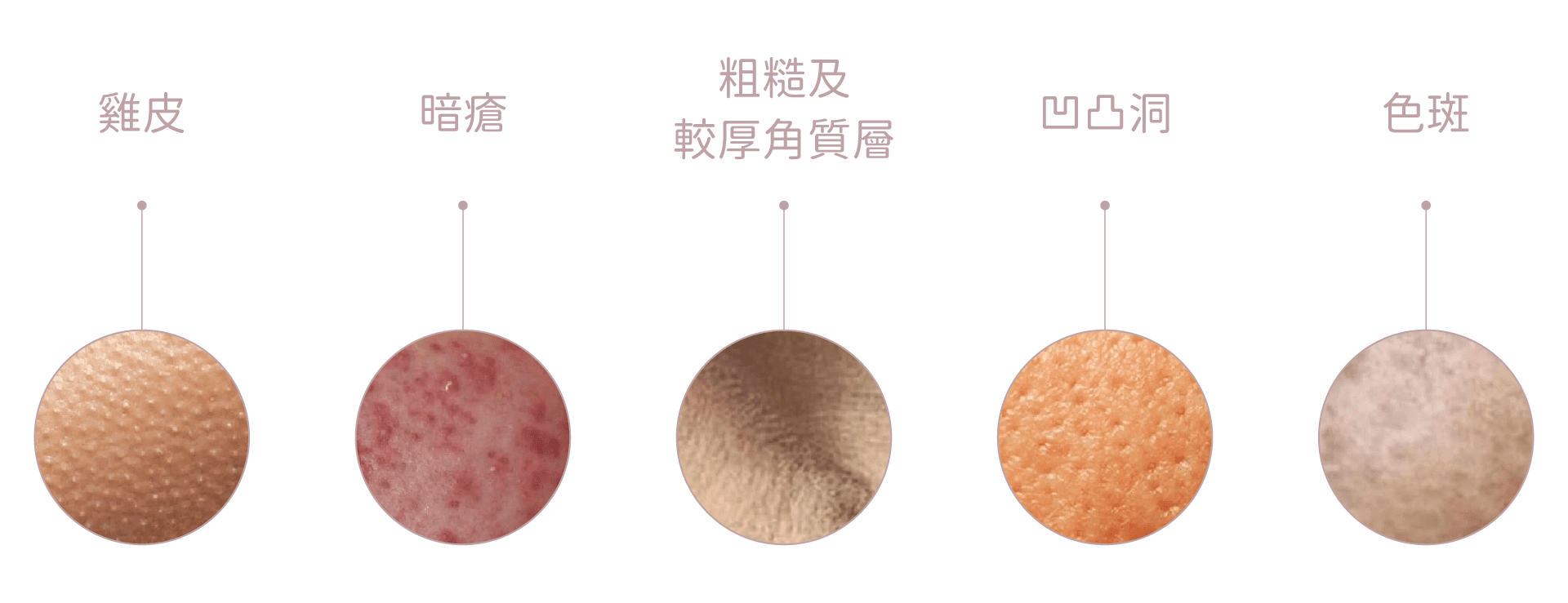 適合陶瓷肌的皮膚問題