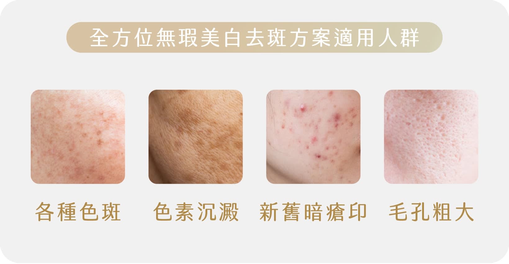 適用人群