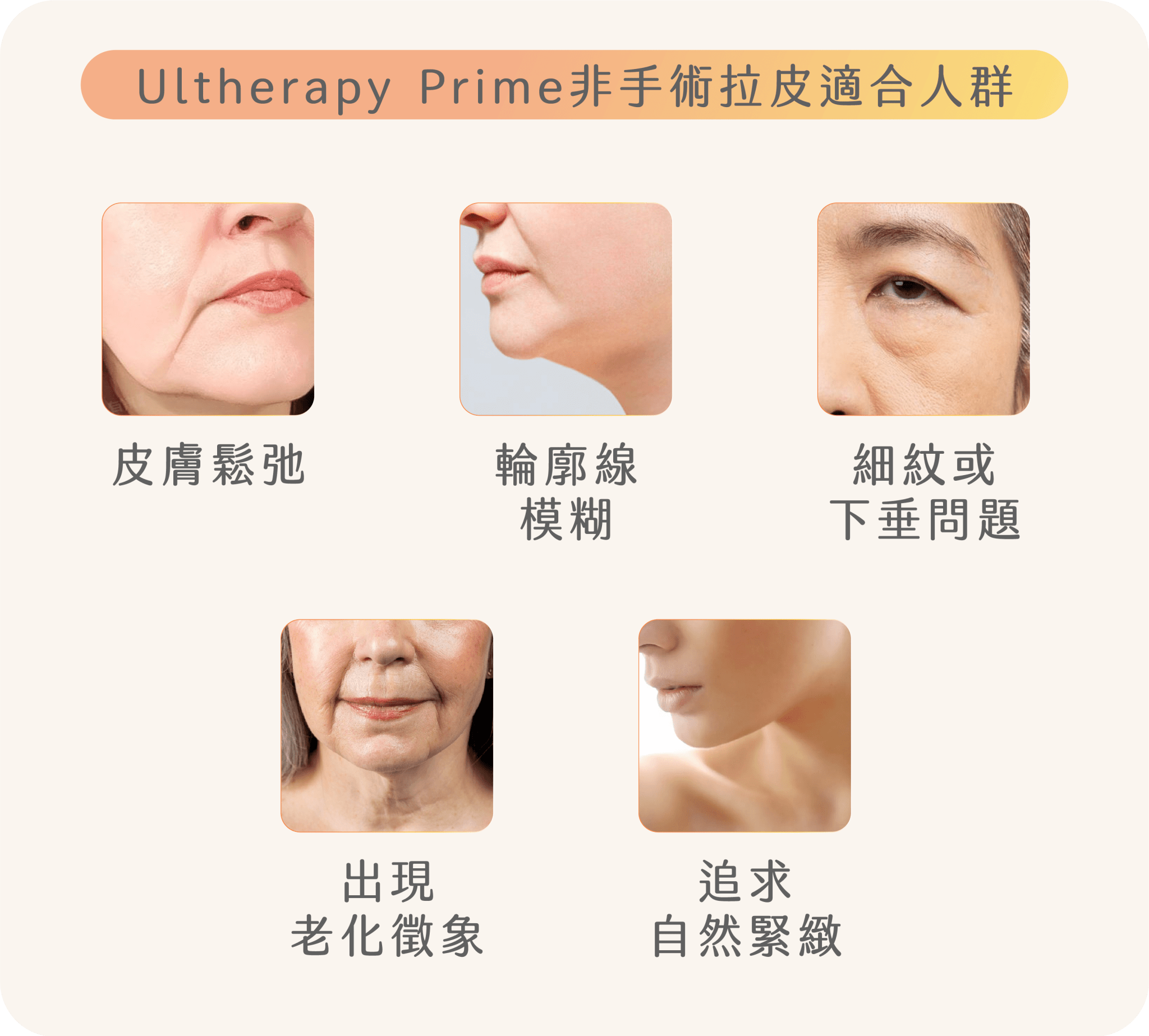 Ultherapy Prime非手術拉皮適合人群