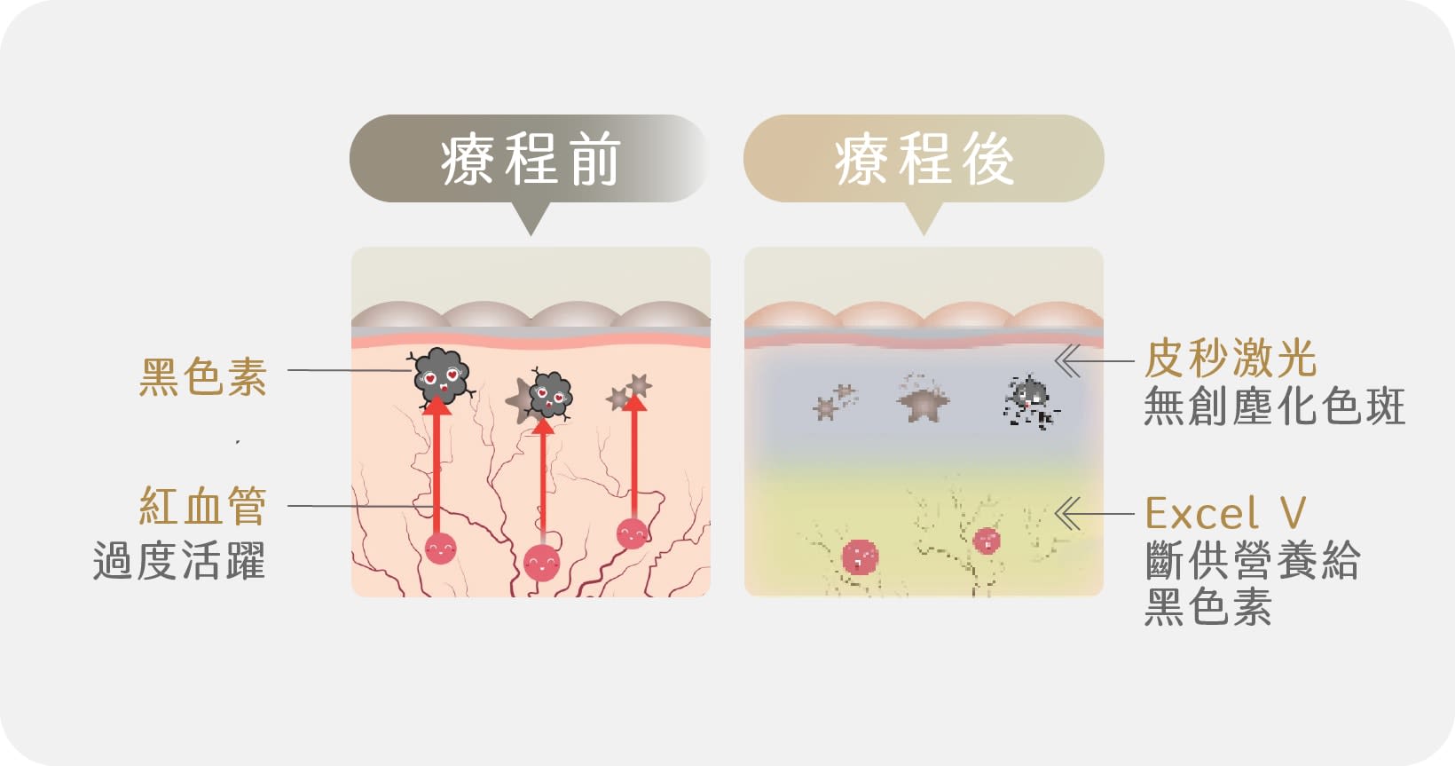 全方位無瑕美白去斑方案 