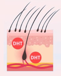 DHT