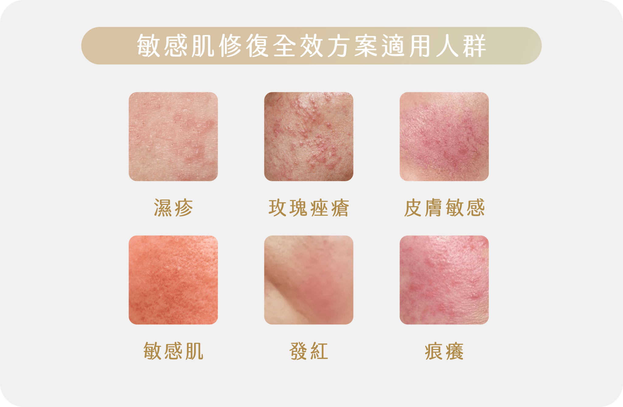 敏感肌修復全效方案適用人群