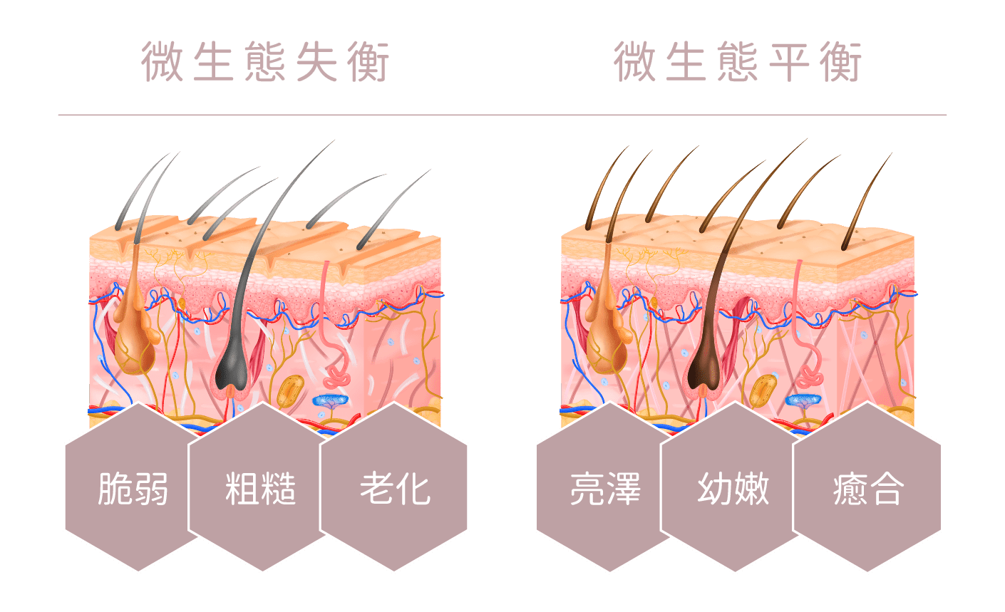 少女針功效-改善微生態