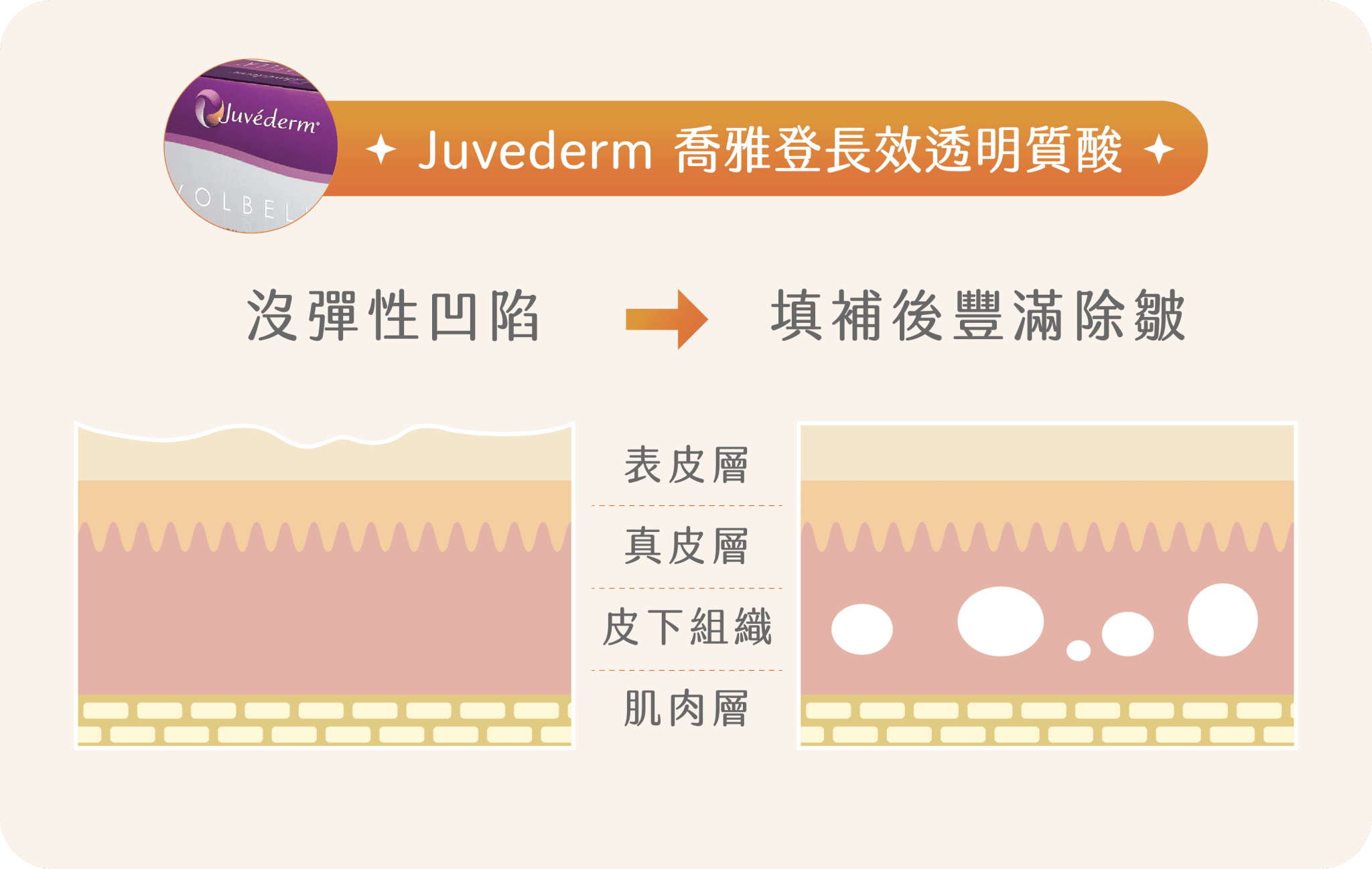 治療思路
