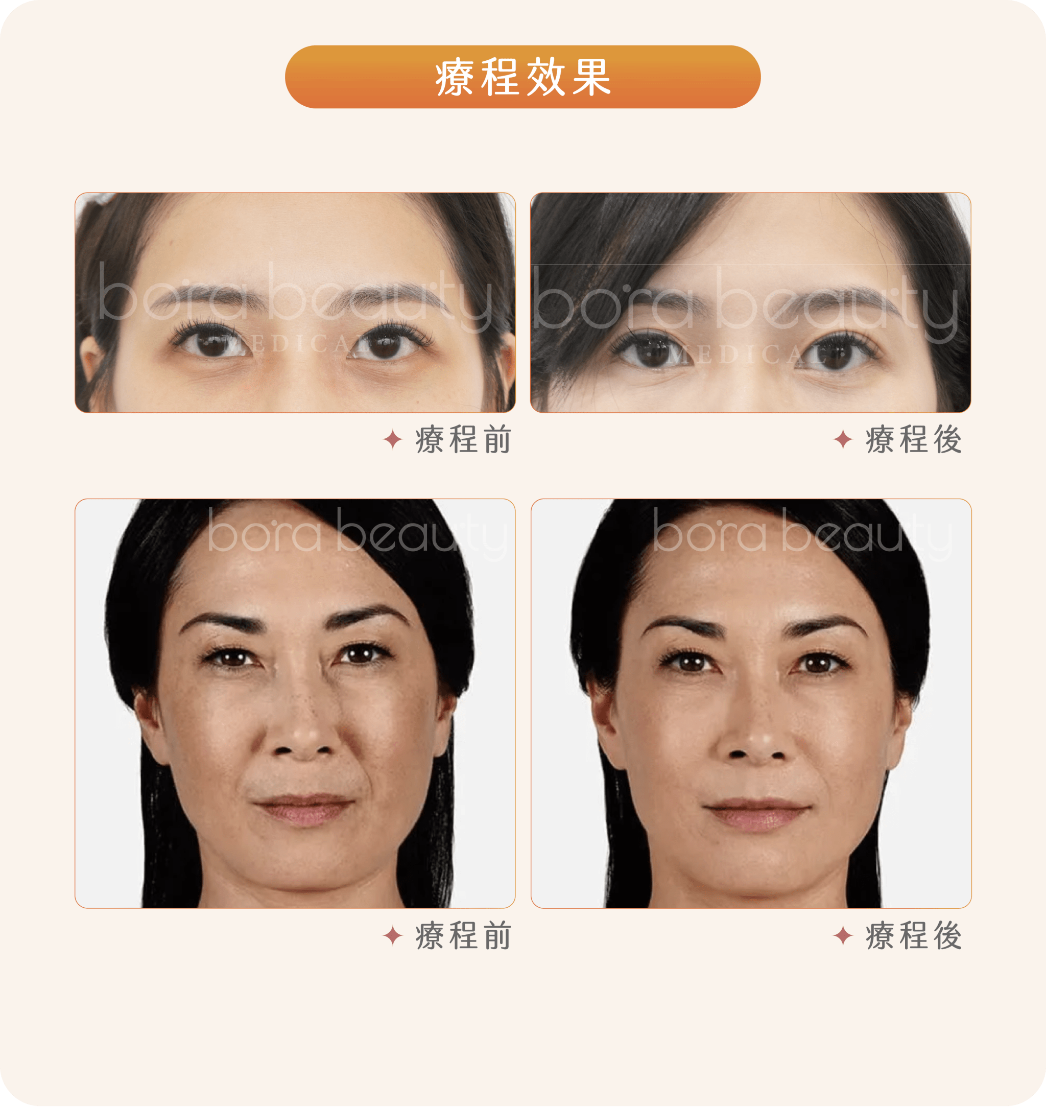 療程效果