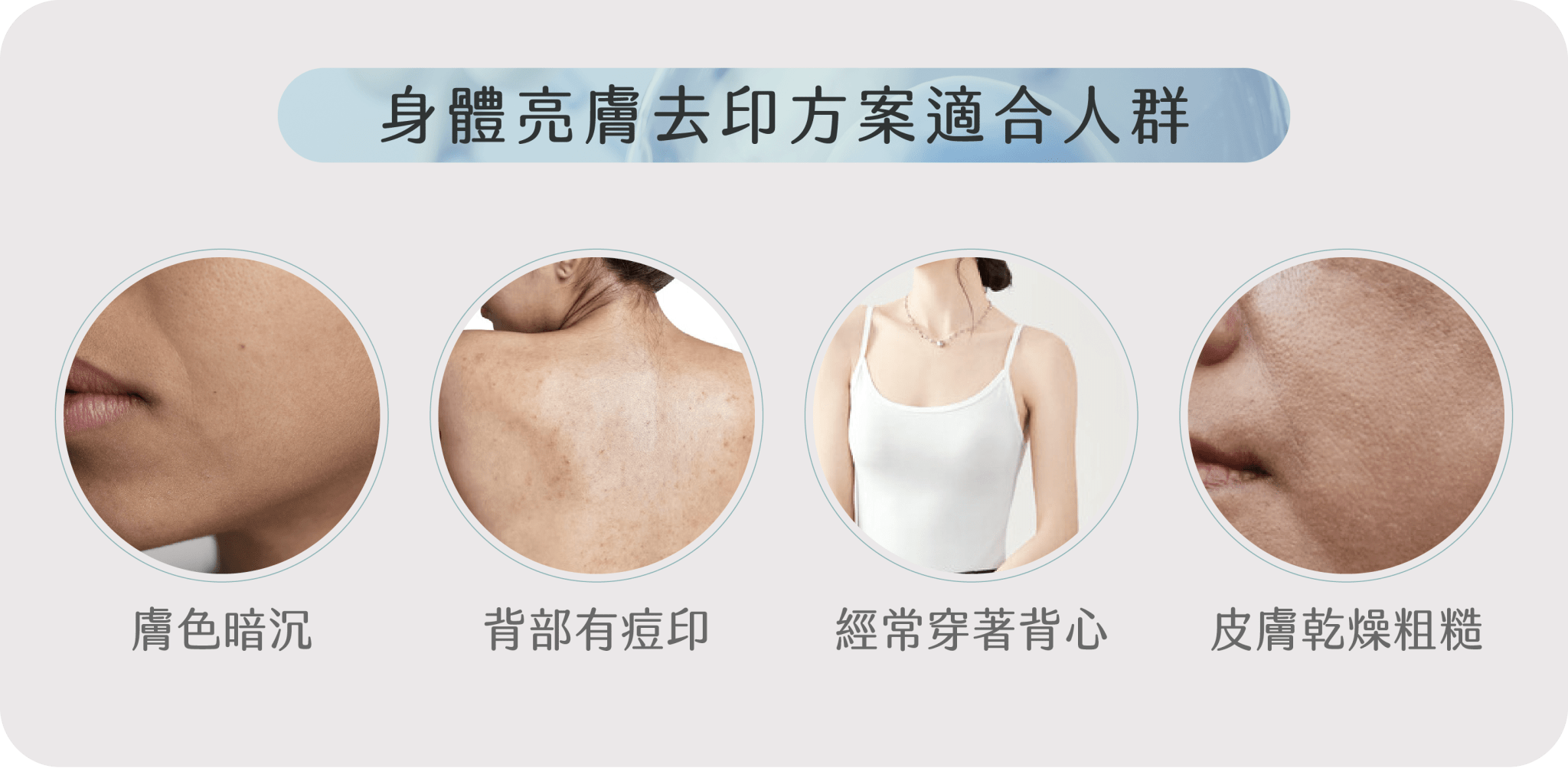 身體亮膚去印方案適合人群