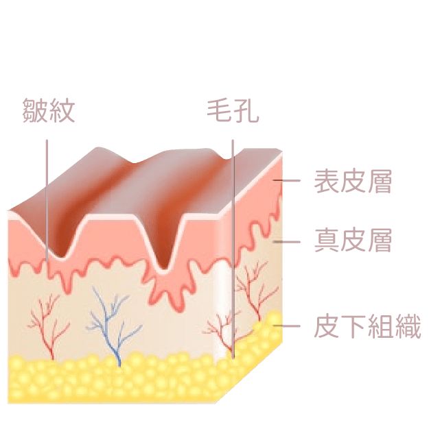 眼紋問題