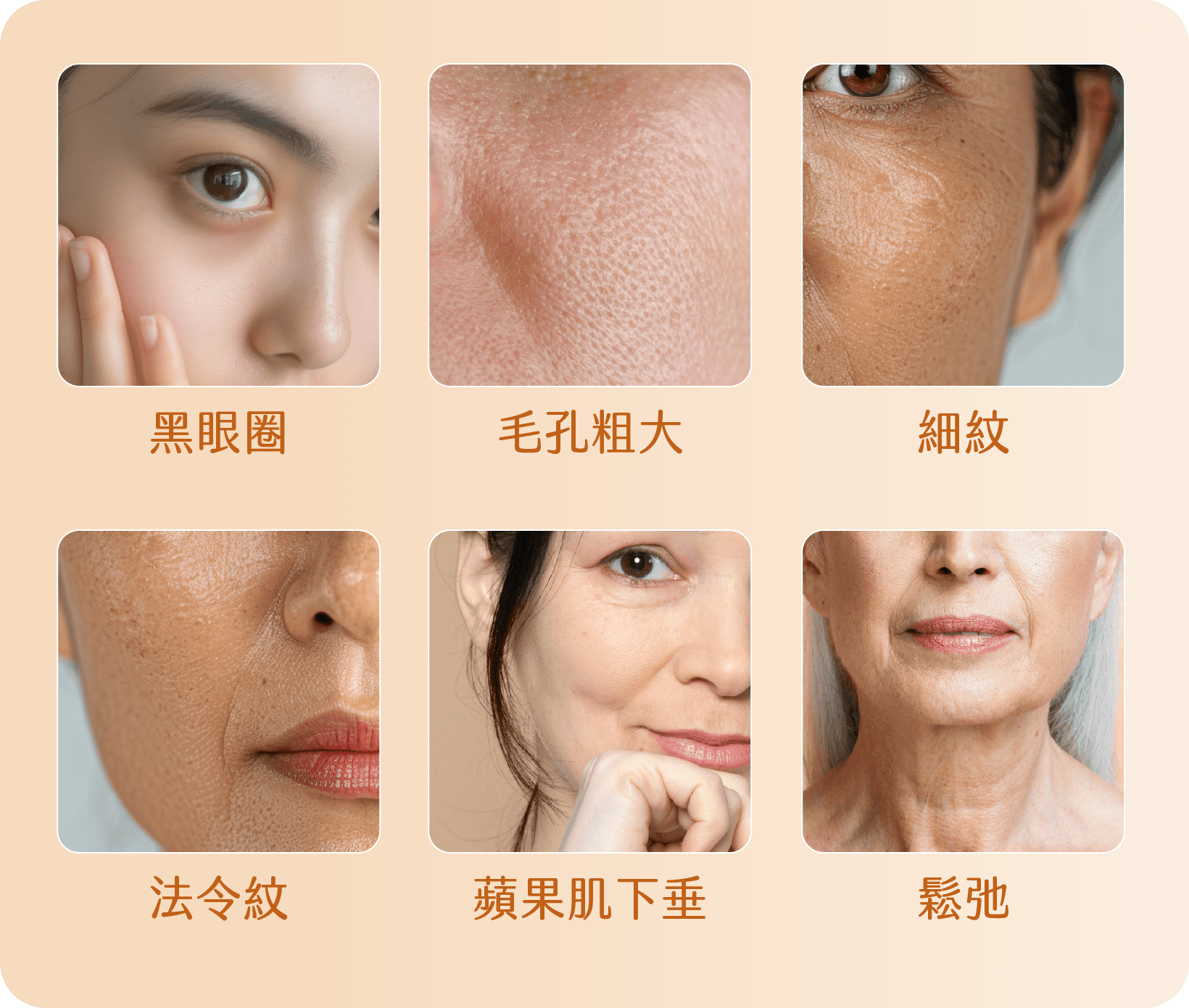 肌膚初老徵兆