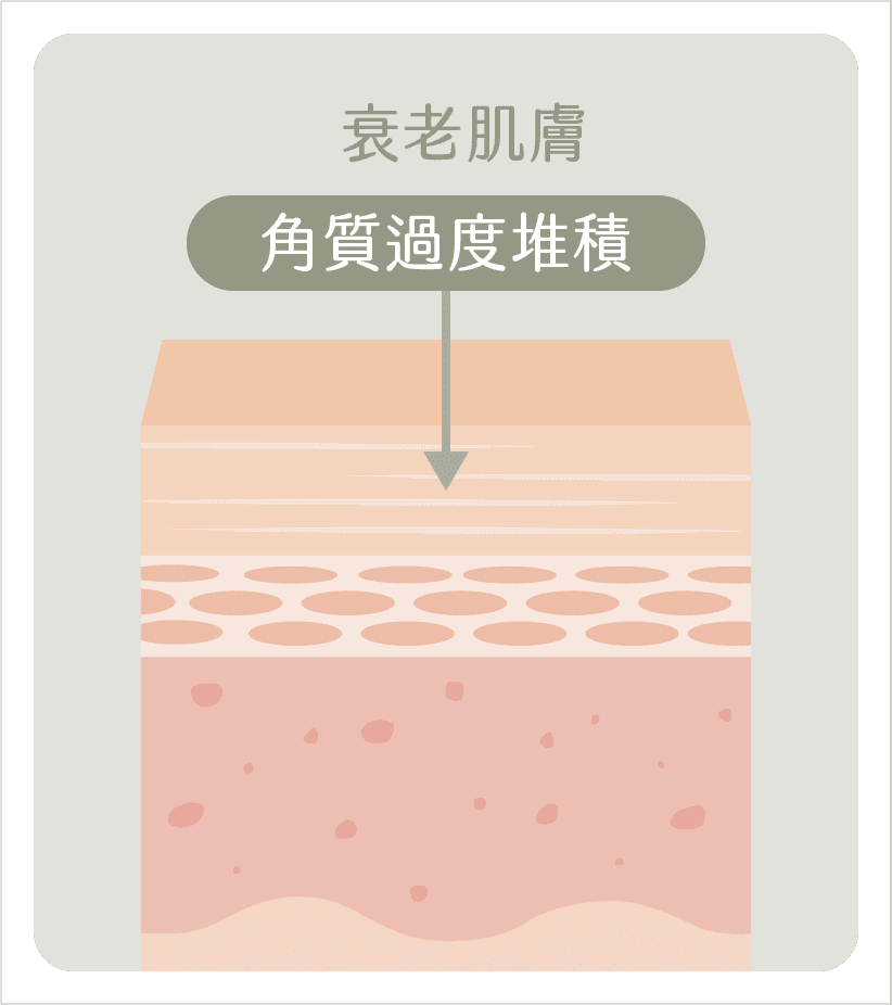 衰老肌膚