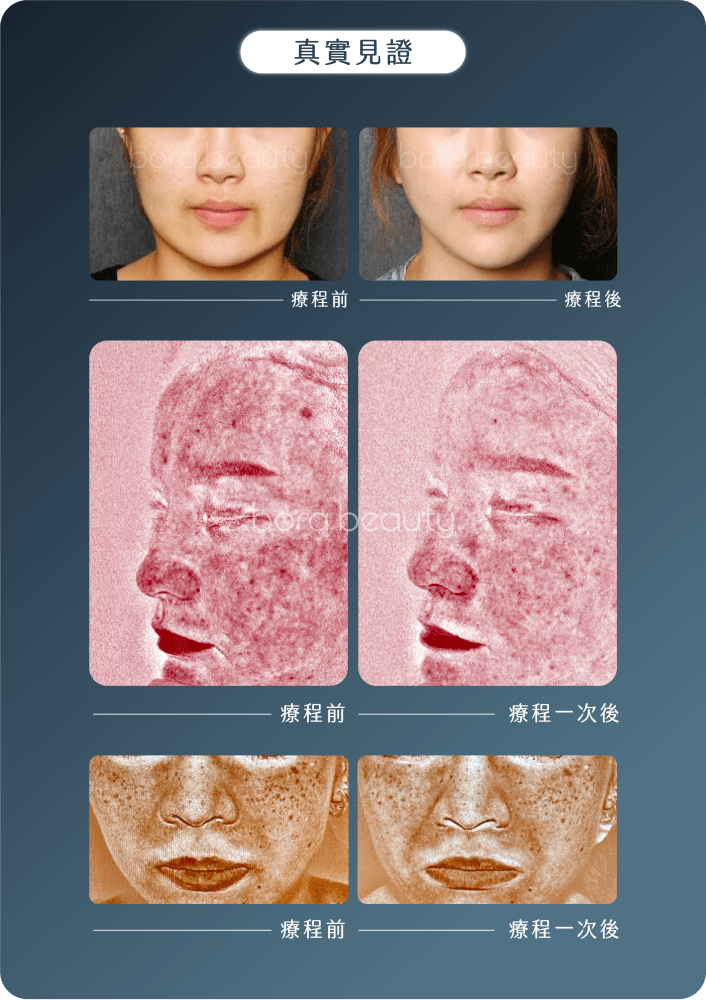 bora beauty對比圖
