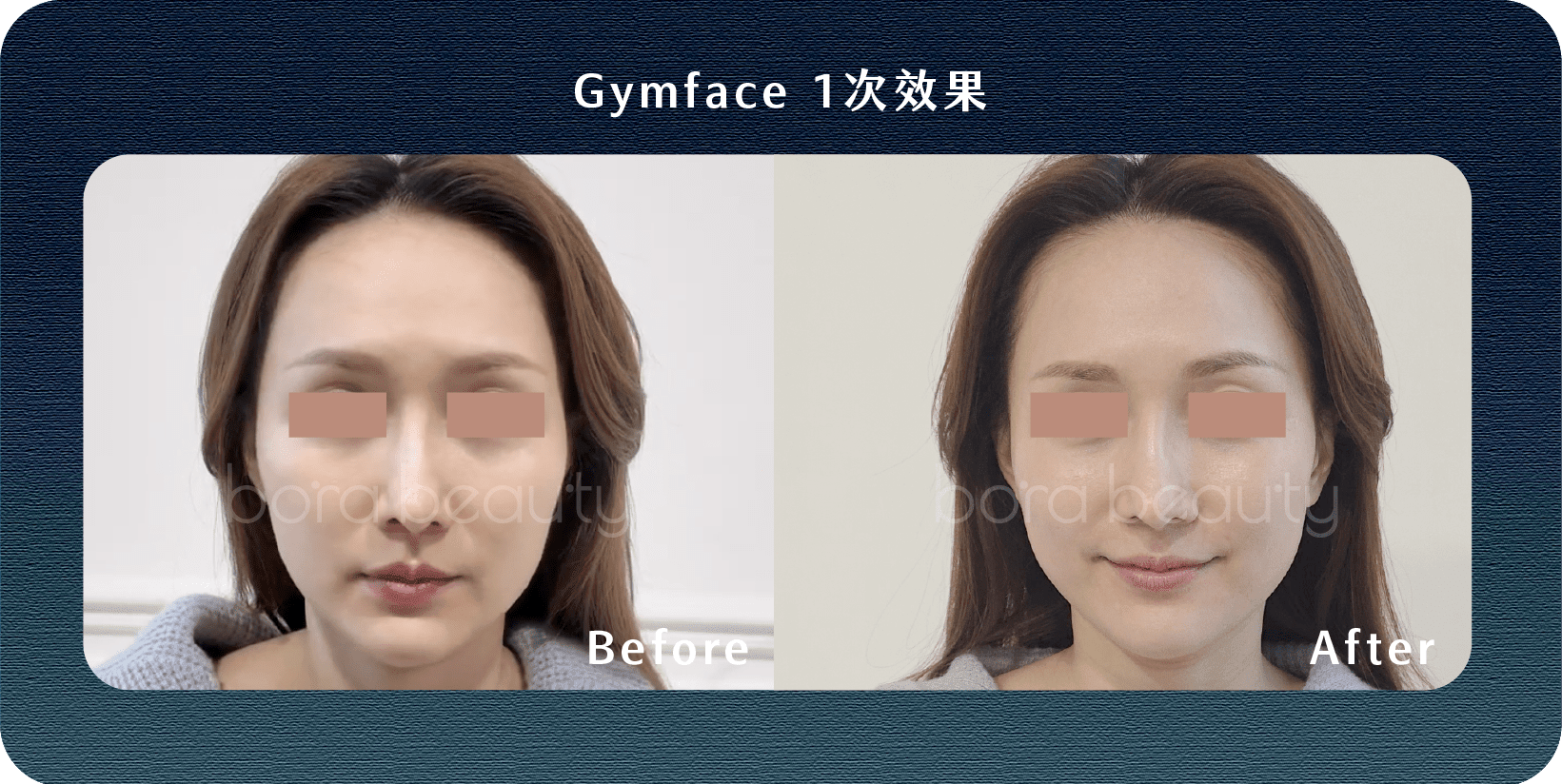 GymFACE前後對比效果