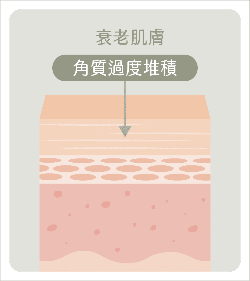 衰老肌膚