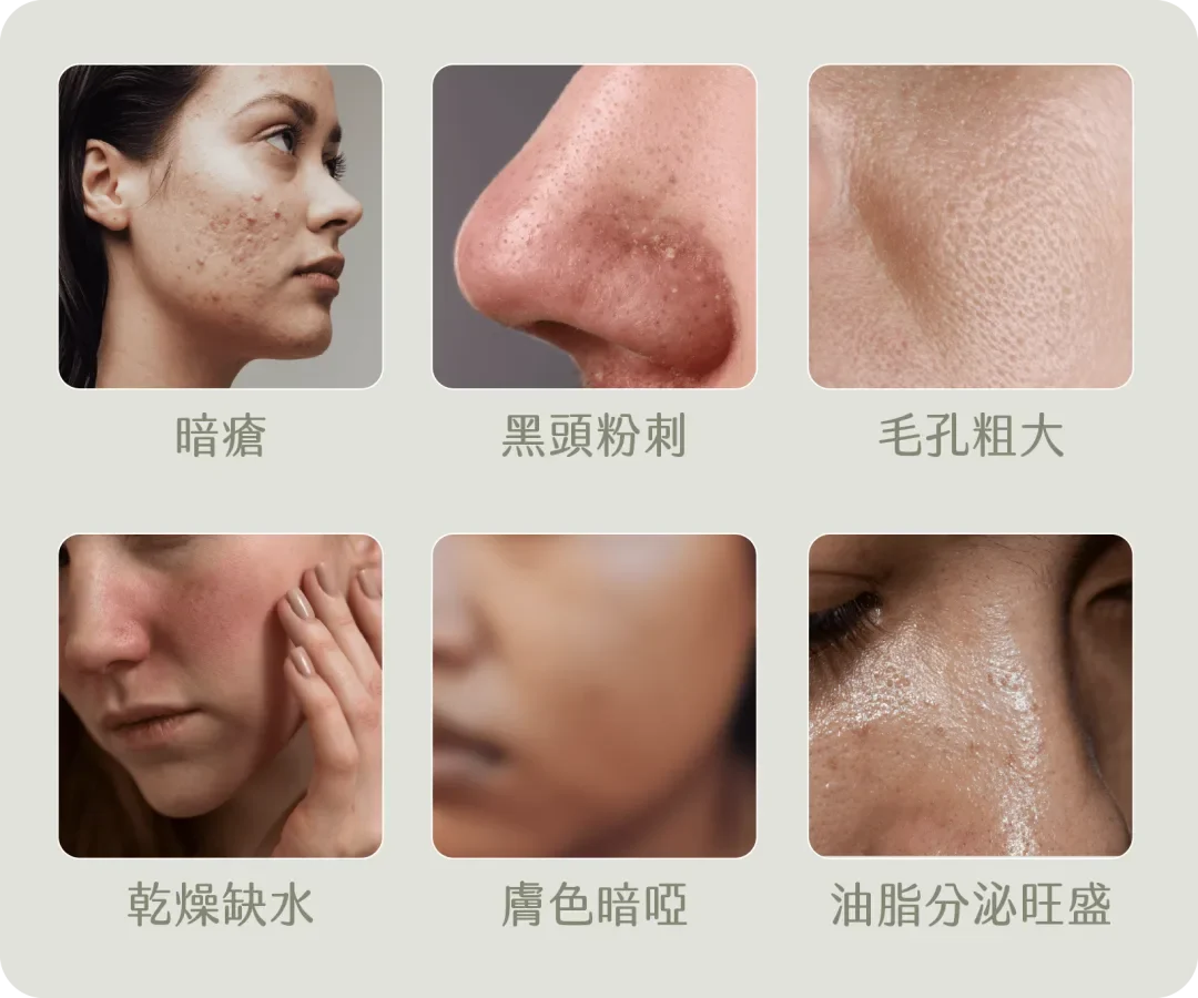 Aqua Peel原理