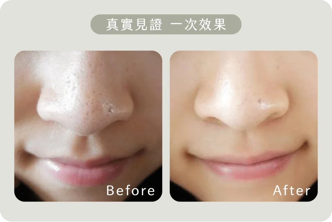 Aqua Peel效果