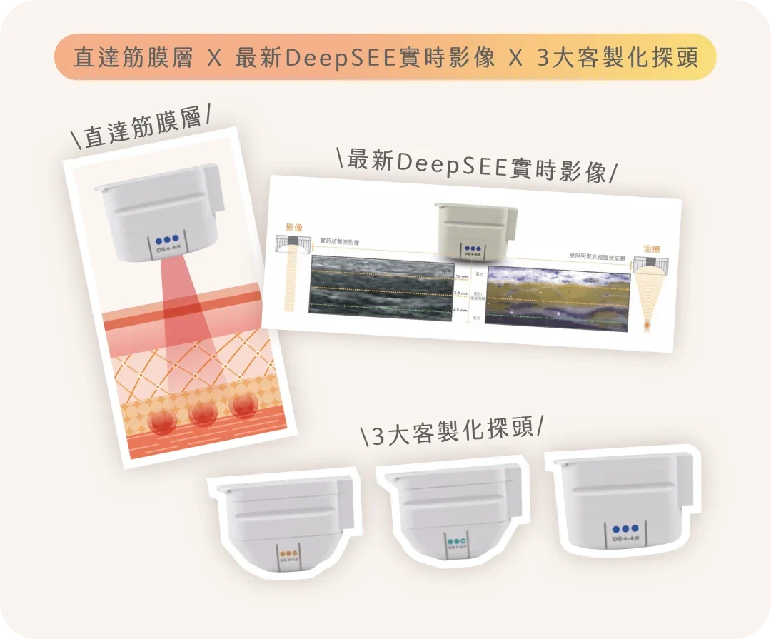 Ultherapy Prime非手術拉皮是甚麼