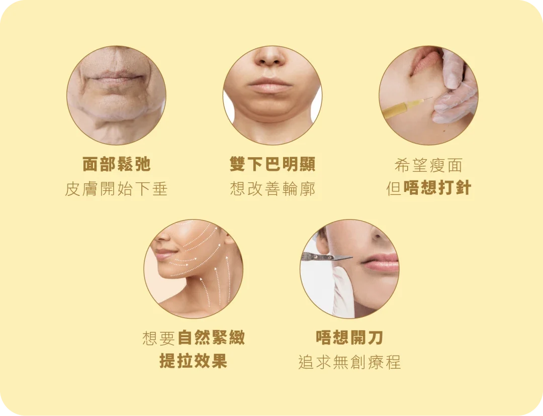 Hifu Gold 黃金緊膚索適用人群
