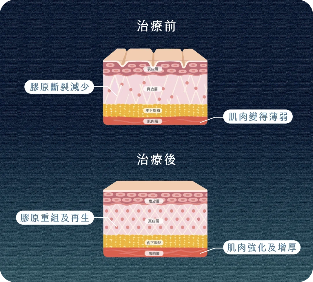 GymFACE重塑肌底療程技術