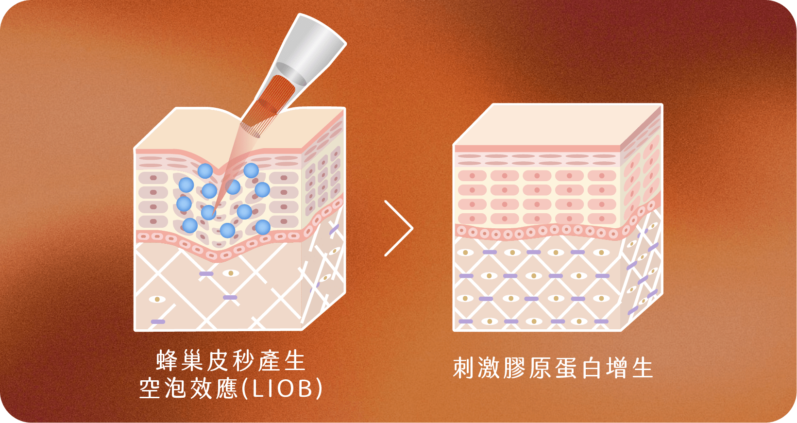 蜂巢皮秒 蜂巢皮秒