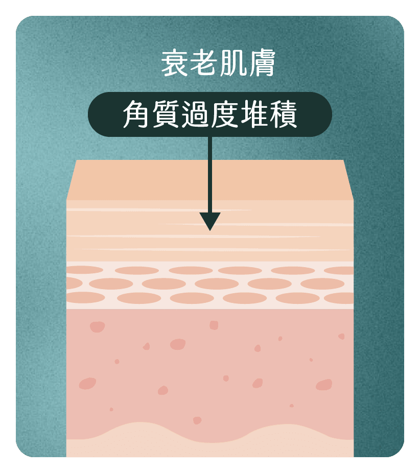 衰老肌膚