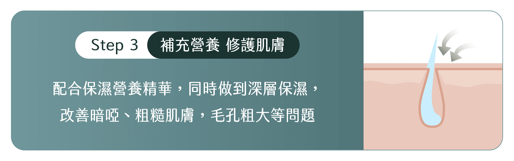 Aqua Peel同傳統針清分別