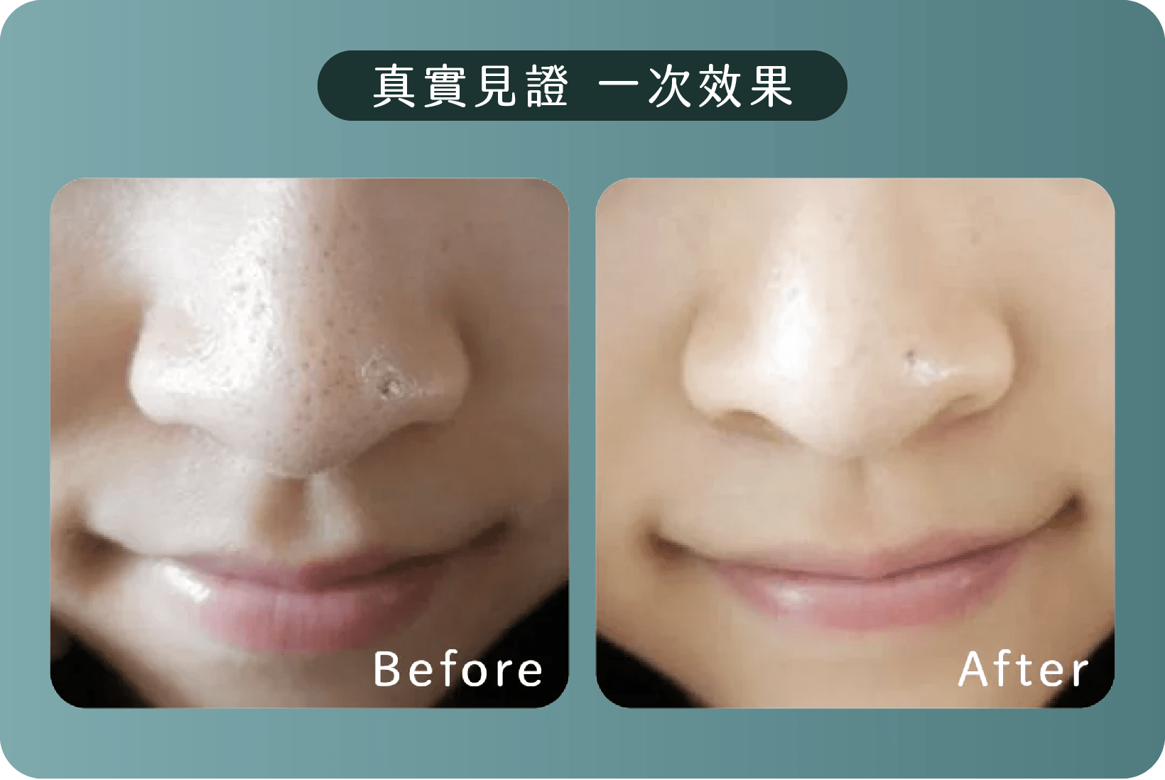 Aqua Peel效果