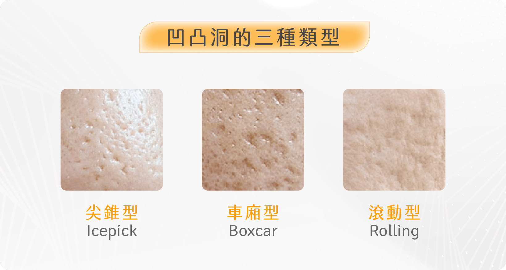 凹凸洞的三種類型 凹凸洞的三種類型