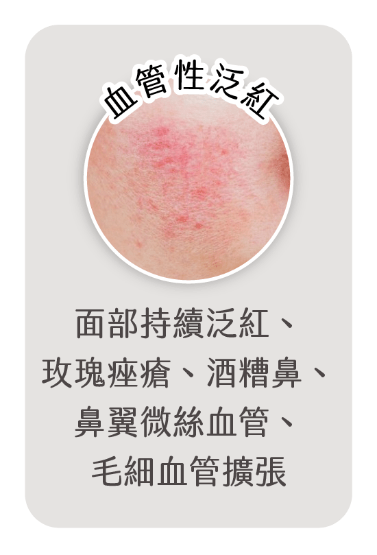 血管性泛紅
