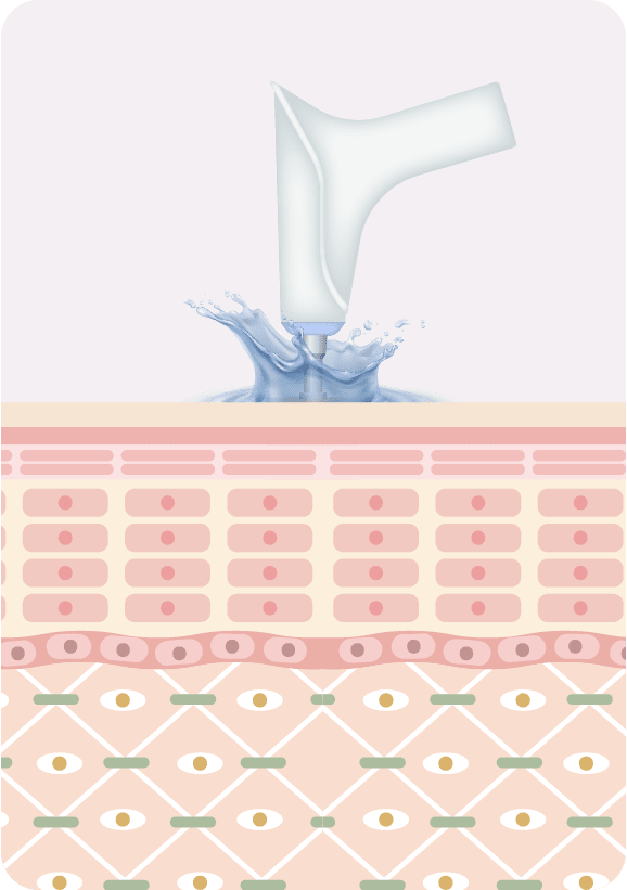 BELLA PACT 模式 BELLA PACT 模式