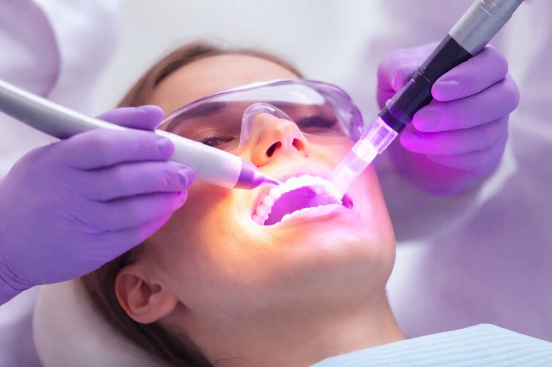 Laser Dental Surgery