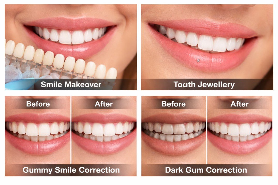 Cosmetic Dentistry