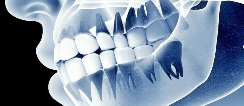 Digital Radiography