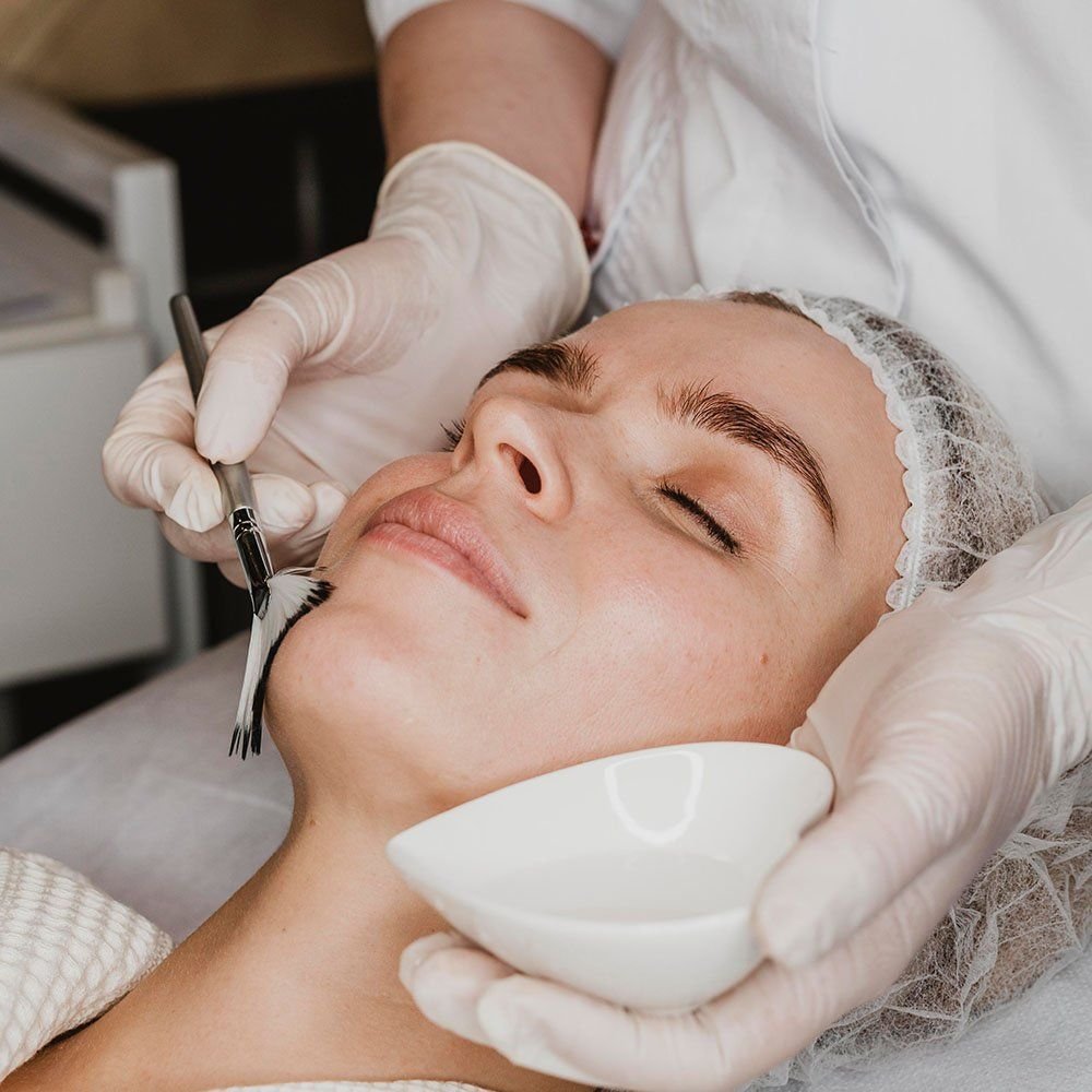 Peel Treatments