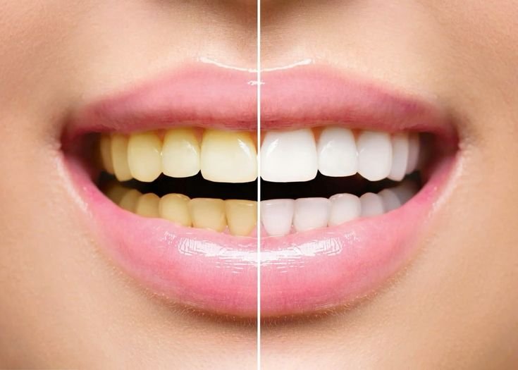 Cosmetic Dentistry