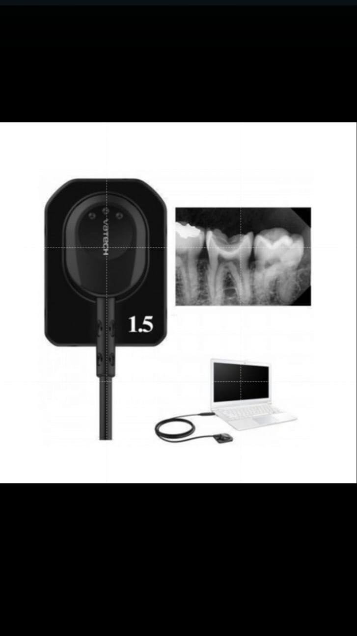 Digital X-Ray